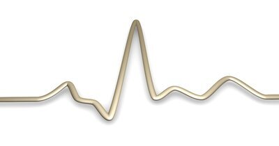 T-golfmorfologie is voorspellend voor overlijdensrisico