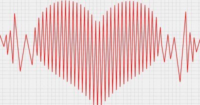 Nederlandse studie toont effect van gezondere levensmiddelenhandel op cardiovasculaire risico’s