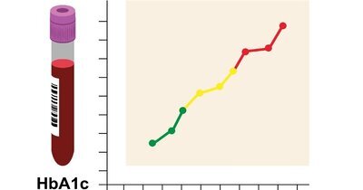 Instabiel HbA1c geeft slechte uitkomsten in eerstelijns cohort